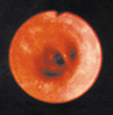 Inflamed Lung
